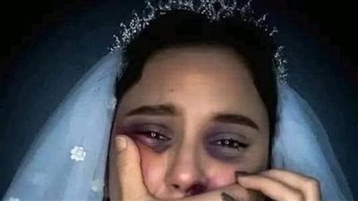 روايه لعنه المشرحه جميع الفصول كاملة بقلم اسماعيل موسى