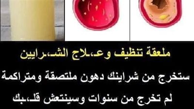ملعقة تنظيف وعلاج الشرايين: ستخرج من شرايينك دون ملتصقة ومتراكمة 